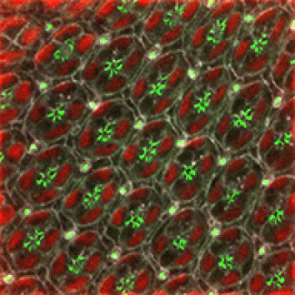 Research reveals a novel link between congenital cataracts and dynamin-binding protein